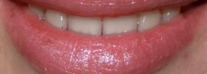 Givenchy лимитка 2009 Rouge Interdit Shine in- Poetique Camelia