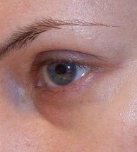 Lancome hydra zen neurocalm вокруг глаз