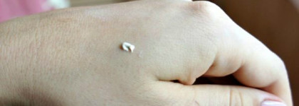 Мои маленькие помощники или точечные средства для коррекции акне