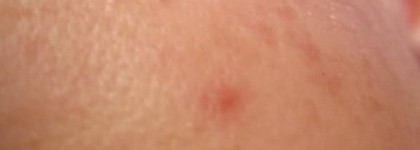 Маскировка на местности. Консилеры Shiseido & Mufe