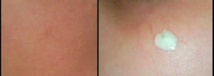 Куперозу нет! - La Roche Posay Rosaliac XL Riche