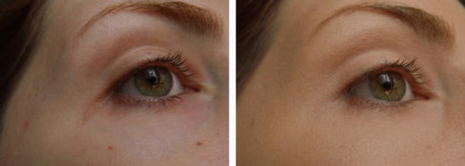 In The Woods Of Autumn Blaze