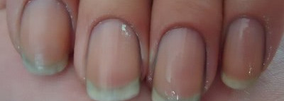 Масло масляное или как я борюсь с сухой кутикулой