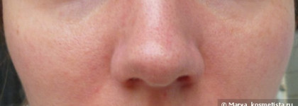 Clinique Redness Solution - серия от покраснений
