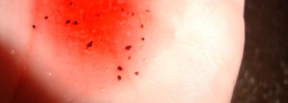 Strawberry Collection