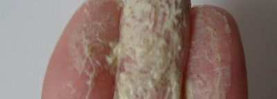 Мои помощники в уходе за кожей