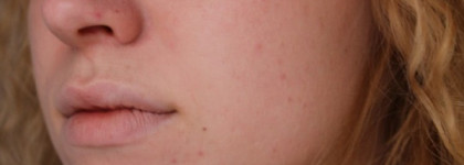 Многофункциональный крем для коррекции тона Almea CC Complete Correction Cream в оттенке medium shade