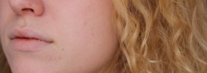 Многофункциональный крем для коррекции тона Almea CC Complete Correction Cream в оттенке medium shade