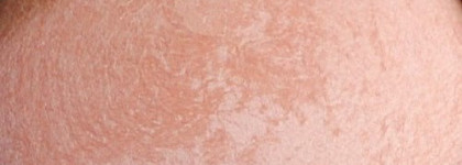 Chanel Joues Contraste Powder Blush #58 Fresque - Сухие румяна