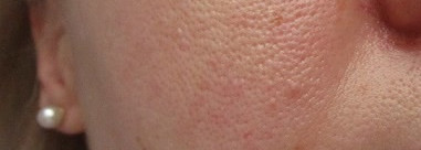 La Roche Posay Toleriane Teint Mattifying Mousse Foundation №01 Ivory