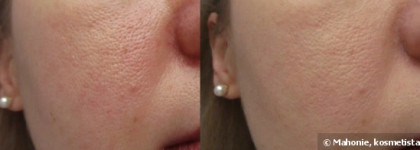 La Roche Posay Toleriane Teint Mattifying Mousse Foundation №01 Ivory