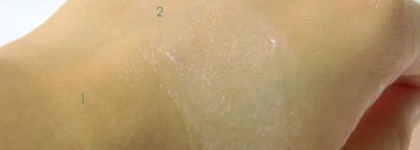 Выбираем ромашку: Pure Calmille от Yves Rocher