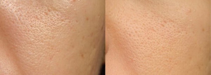 Christian Dior: Diorskin Forever Compact SPF 25 030 Medium Beige (миниатюра)