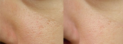 Catrice Cosmetics: Smoothing Refiner for Invisible Pores and Lines