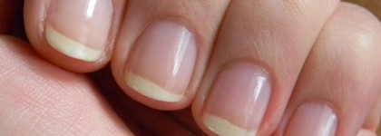 Yves Rocher: Correction Shine and fill base coat and Shiny Clear Nail Polish