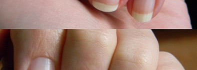 Yves Rocher: Correction Shine and fill base coat and Shiny Clear Nail Polish