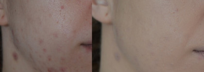 Rimmel - Skin Perfecting Medium Coverage Foundation Lasting Finish Nude 25Hr SPF 20 – 200 Soft Beige