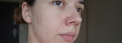 SVR Lysalpha Cicapeel Gel - Пилинг для жирной и проблемной кожи