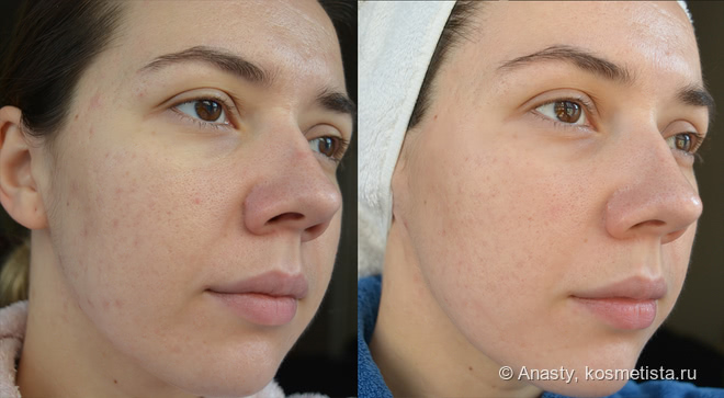 Lancome Visionnaire - Crescendo Peel Cream и Advanced Skin Corrector
