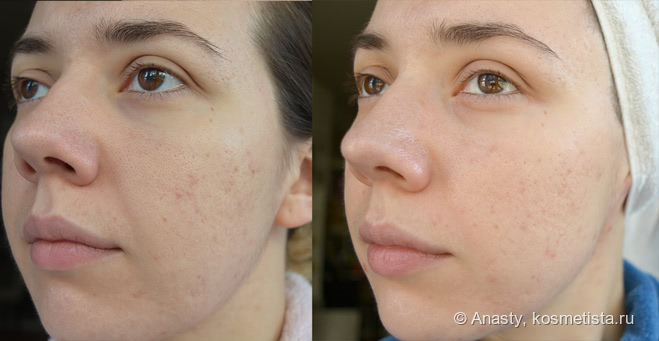 Lancome Visionnaire - Crescendo Peel Cream и Advanced Skin Corrector