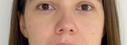 Укрощение строптивой или Мой уход за проблемной кожей