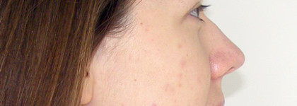 Укрощение строптивой или Мой уход за проблемной кожей