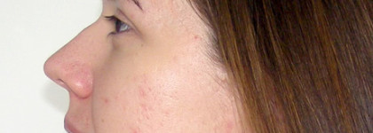 Укрощение строптивой или Мой уход за проблемной кожей