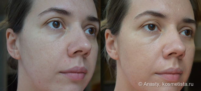 Находки и разочарования в аптечном уходе Avene, Pharmaceris