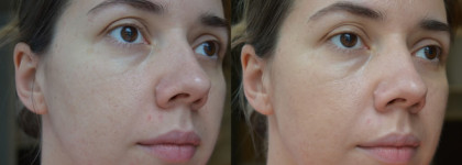 Находки и разочарования в аптечном уходе Avene, Pharmaceris
