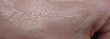 Уход Clinique из серии Anti Blemish Solutions: подробно и по полочкам