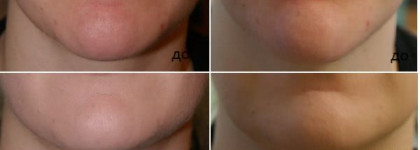 Мой первый БиБик - Skin79 "Oriental Gold BB Сream"