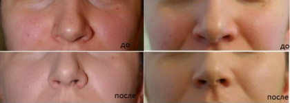 Мой первый БиБик - Skin79 "Oriental Gold BB Сream"