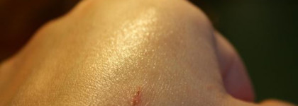 Дарфеномания! Часть 2