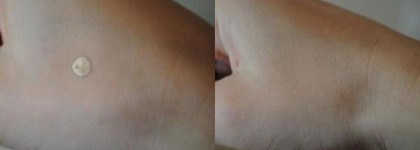 Как неподошедший консилер ArtDeco Perfect Teint Illuminator стал для меня незаменимой вещью