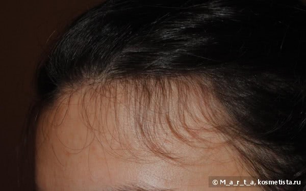 Как правильно использовать аптечные витамины в ампулах для волос | sauna-chelyabinsk.ru