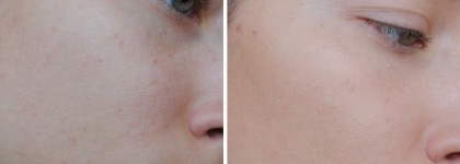 Тональный крем Lancome Teint Miracle SPF 15   03 Beige Diaphane