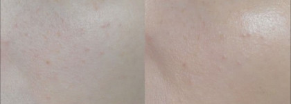 Увлажняющее средство с тональным эффектом  Hydra Zen Neurocalm™ # 2 от Lancome