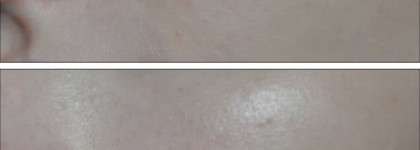 Увлажняющее средство с тональным эффектом  Hydra Zen Neurocalm™ # 2 от Lancome