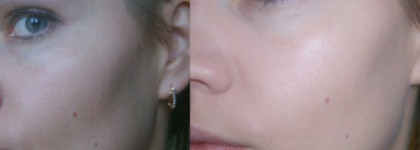 Спонтанная покупка. Dior Diorskin Forever Flawless Perfection Fusion Wear Makeup SPF 25 – Тональный крем-флюид (оттенок 020)