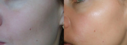 Sisley Phyto-Touches Duo Peche Doree-  Оттеночная пудра «Фитотуш» оттенок персик-золото от Sisley