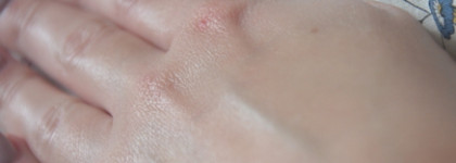 Масло арники с витамином Е от Alpstories. Arnica Macerated Oil With Vitamin E Alpstories