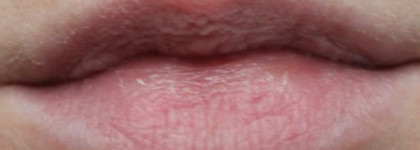 Пилинг для губ: домашнее средство против готового Sally Hansen Gentle Peel for Rough Lips