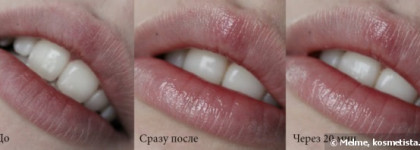 Средство для губ Almea Xlips