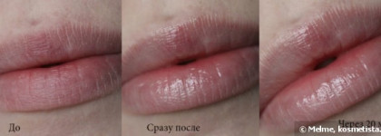 Средство для губ Almea Xlips