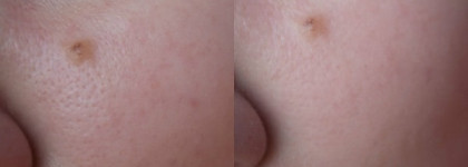 Выравнивающая основа под макияж Shiseido Refining Makeup Primer Base Perfectrice de Teint SPF 15