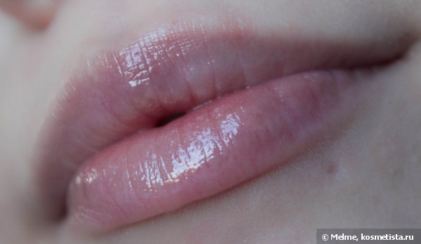Almea Xlips EGF и Xlips Plumper