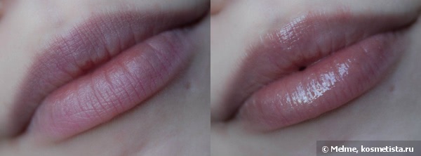 Almea Xlips EGF и Xlips Plumper