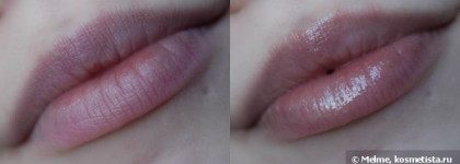 Almea Xlips EGF и Xlips Plumper