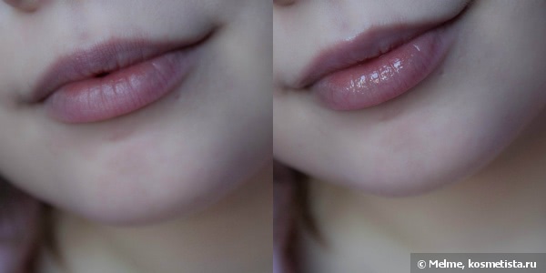 Almea Xlips EGF и Xlips Plumper