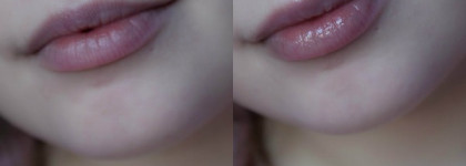 Almea Xlips EGF и Xlips Plumper